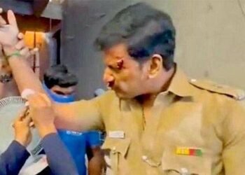 హీరో విశాల్ చేయి ఫ్రాక్చర్