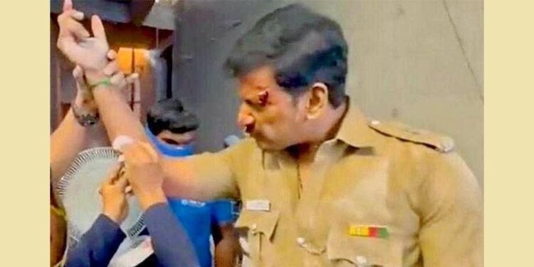 హీరో విశాల్ చేయి ఫ్రాక్చర్